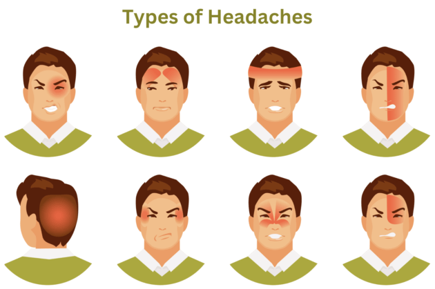 Headaches Unveiled: Deciphering the Mystery Behind the Pain - SPINEPLUS